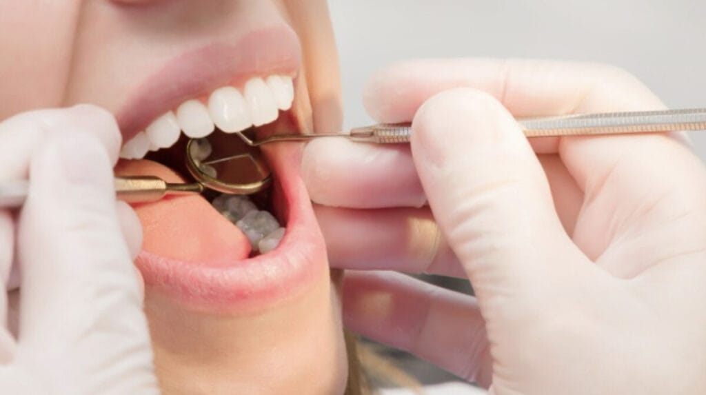 Iflammation Swollen Gums After Treatment