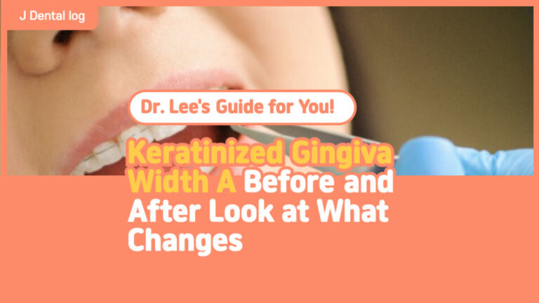 Keratinized Gingiva Width A Before and After Look at What Changes
